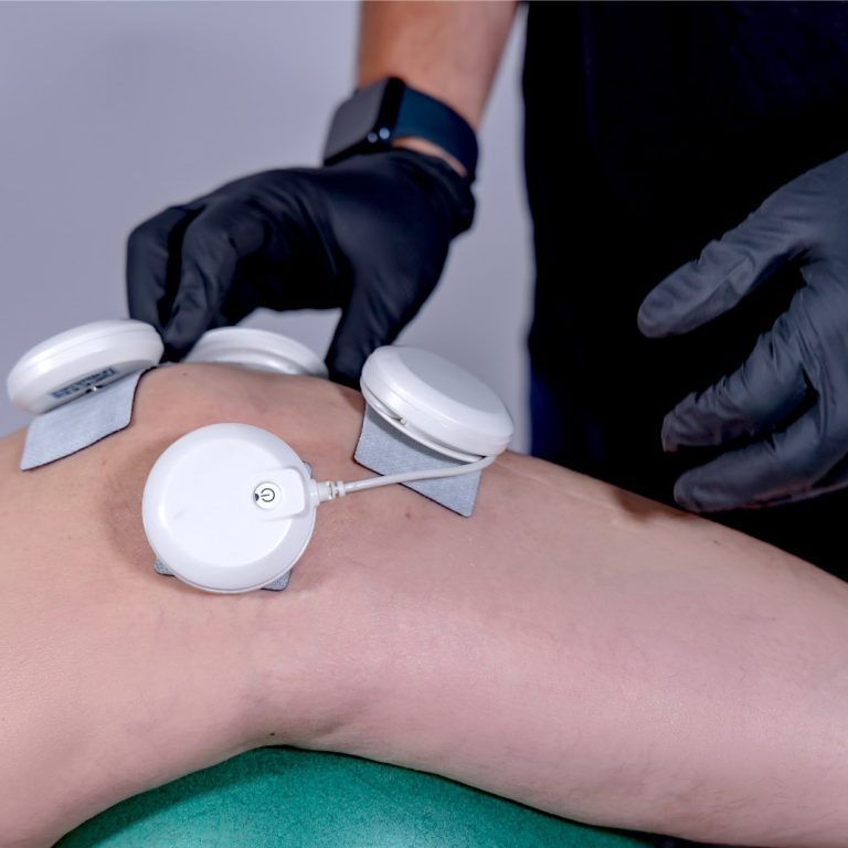 Ηλεκτροθεραπεία